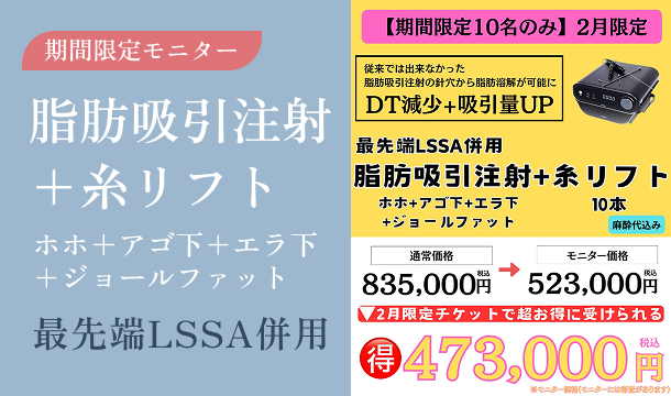期間限定モニター　脂肪吸引注射 ＋ 糸リフト