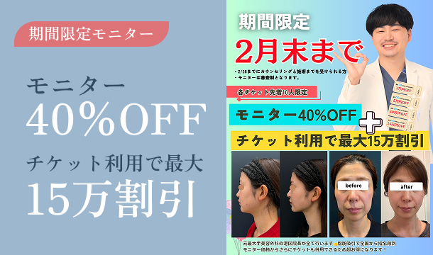 期間限定モニター　40%OFF