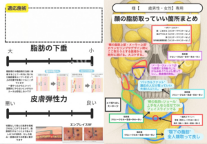 脂肪吸引マップ