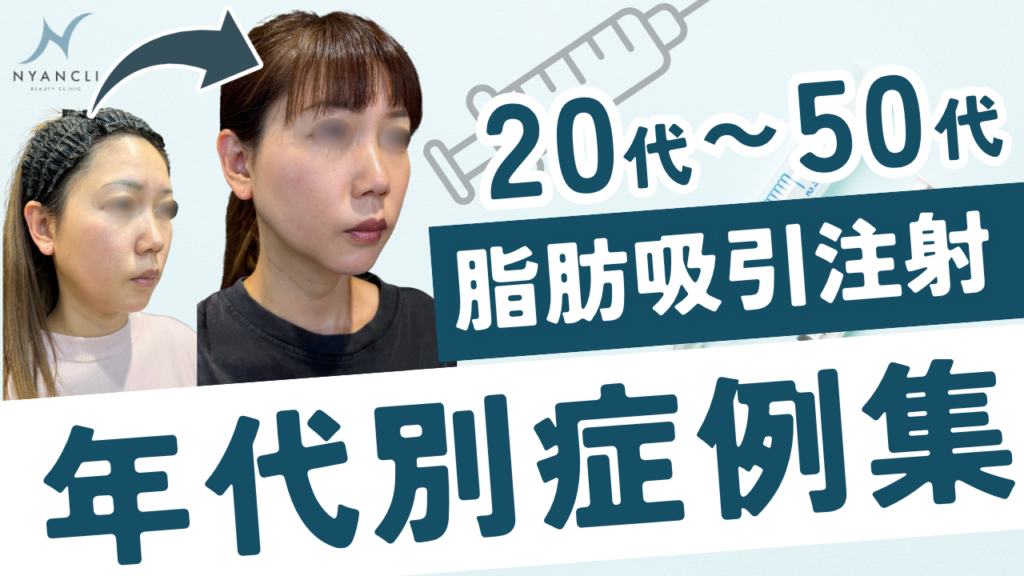 【脂肪吸引注射】年代別症例集