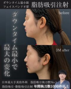症例写真②