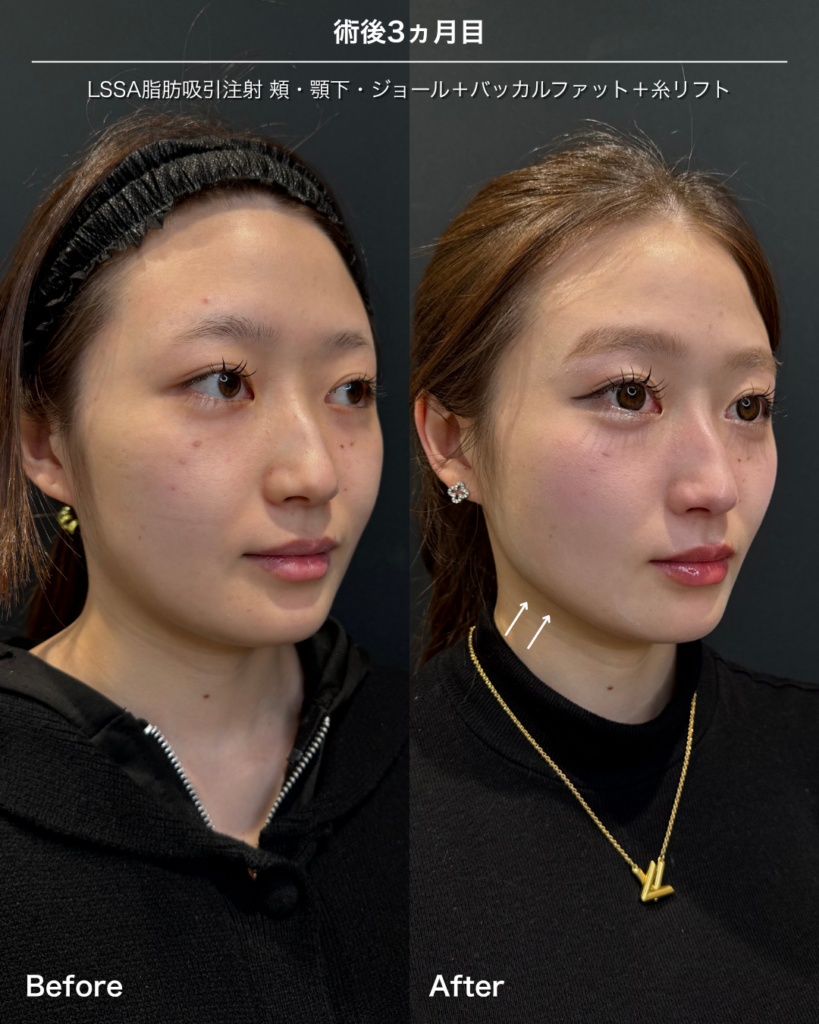 20代症例②