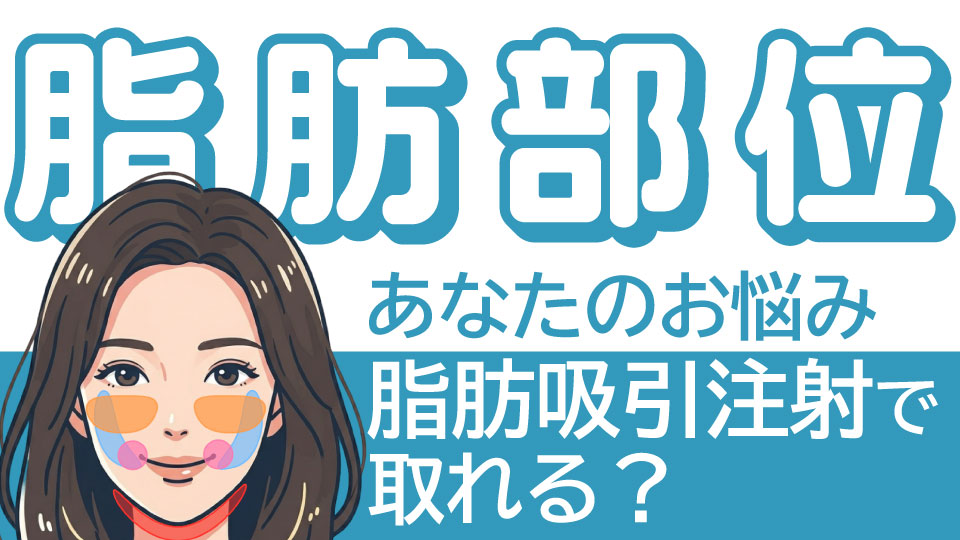 【顔の脂肪部位】バッカル・ジョール・メーラー…私の悩みは「脂肪吸引注射」で取れる？