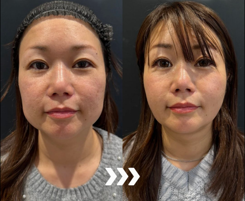 40代症例