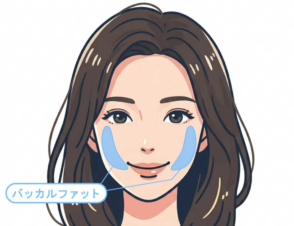 バッカルファット