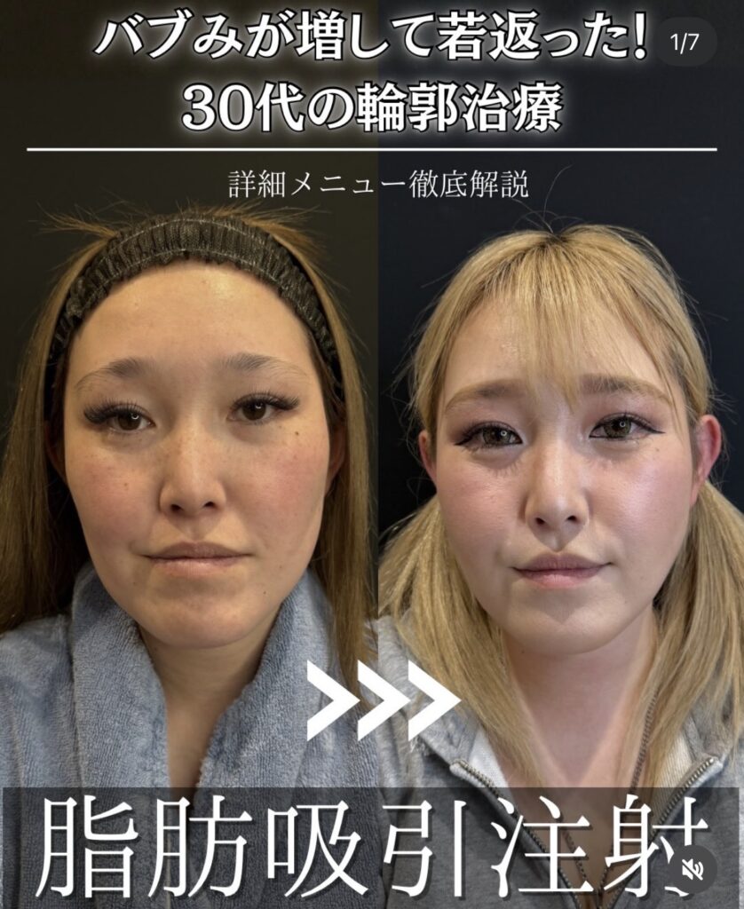 30代症例①