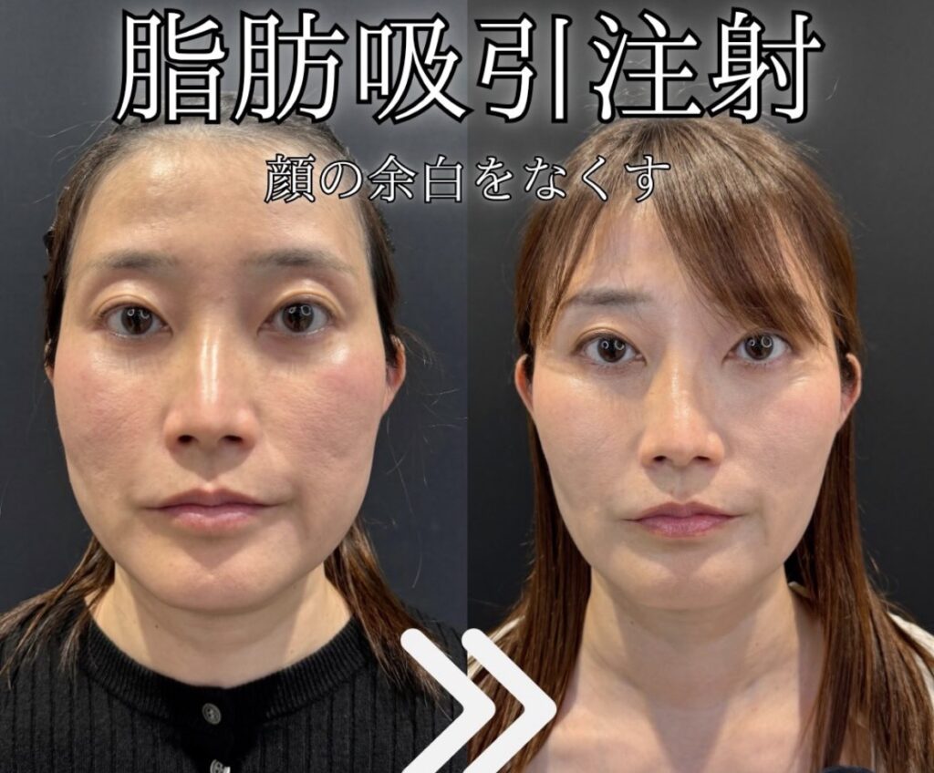 40代症例