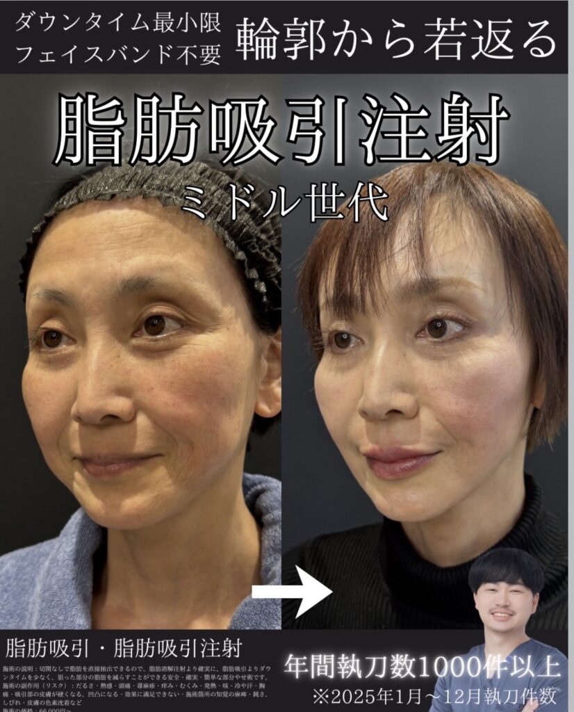 50代症例①