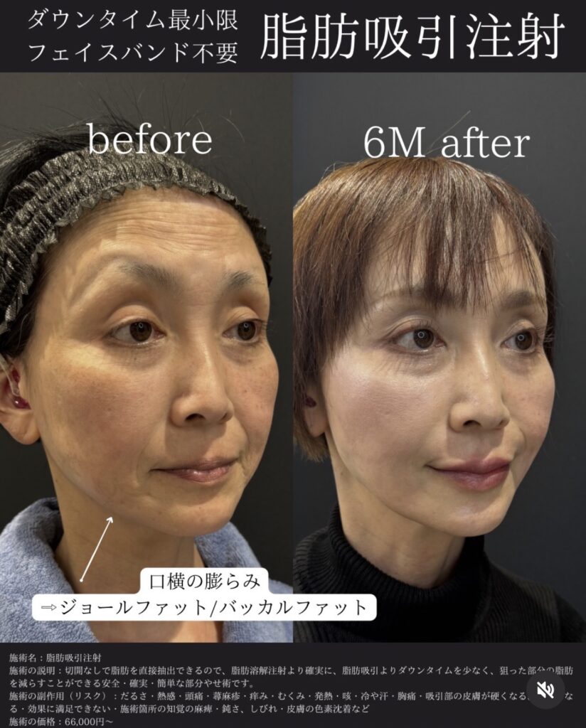 50代症例②