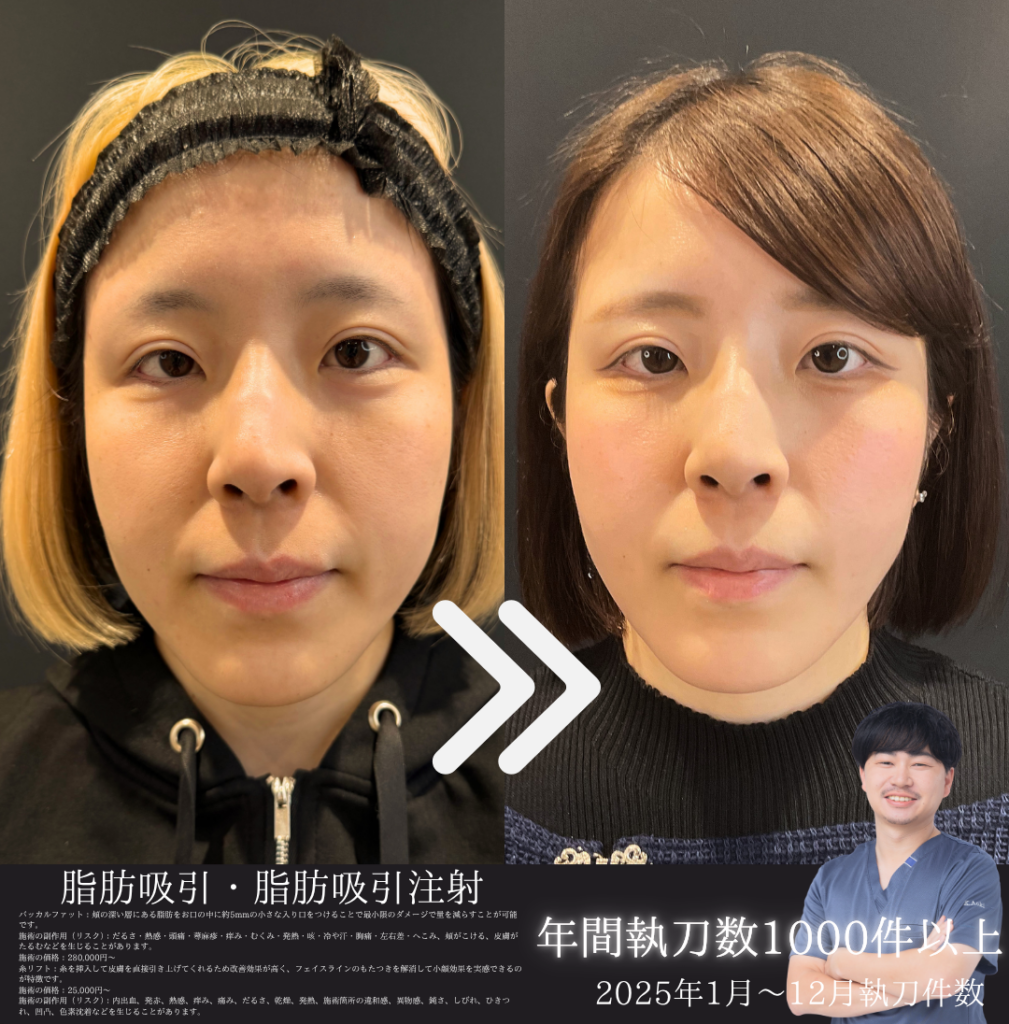 30代症例②