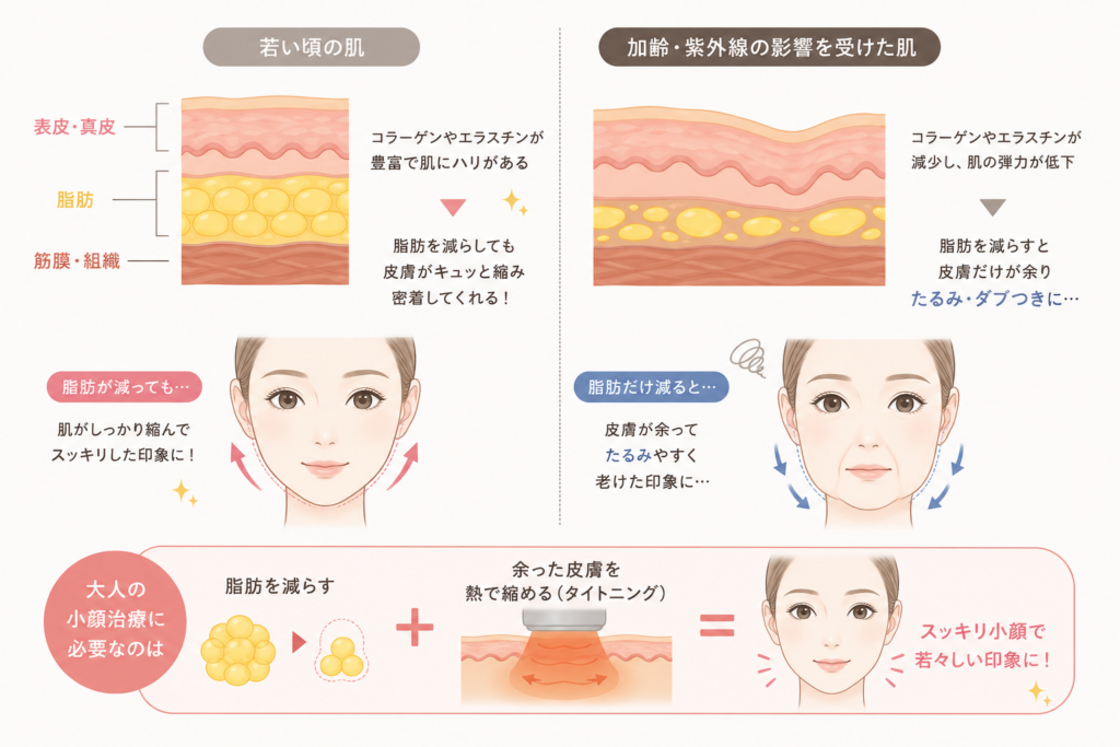 たるみのイメージ