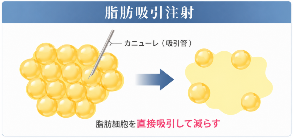 脂肪吸引
