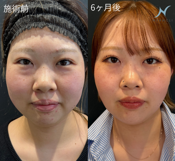 症例写真