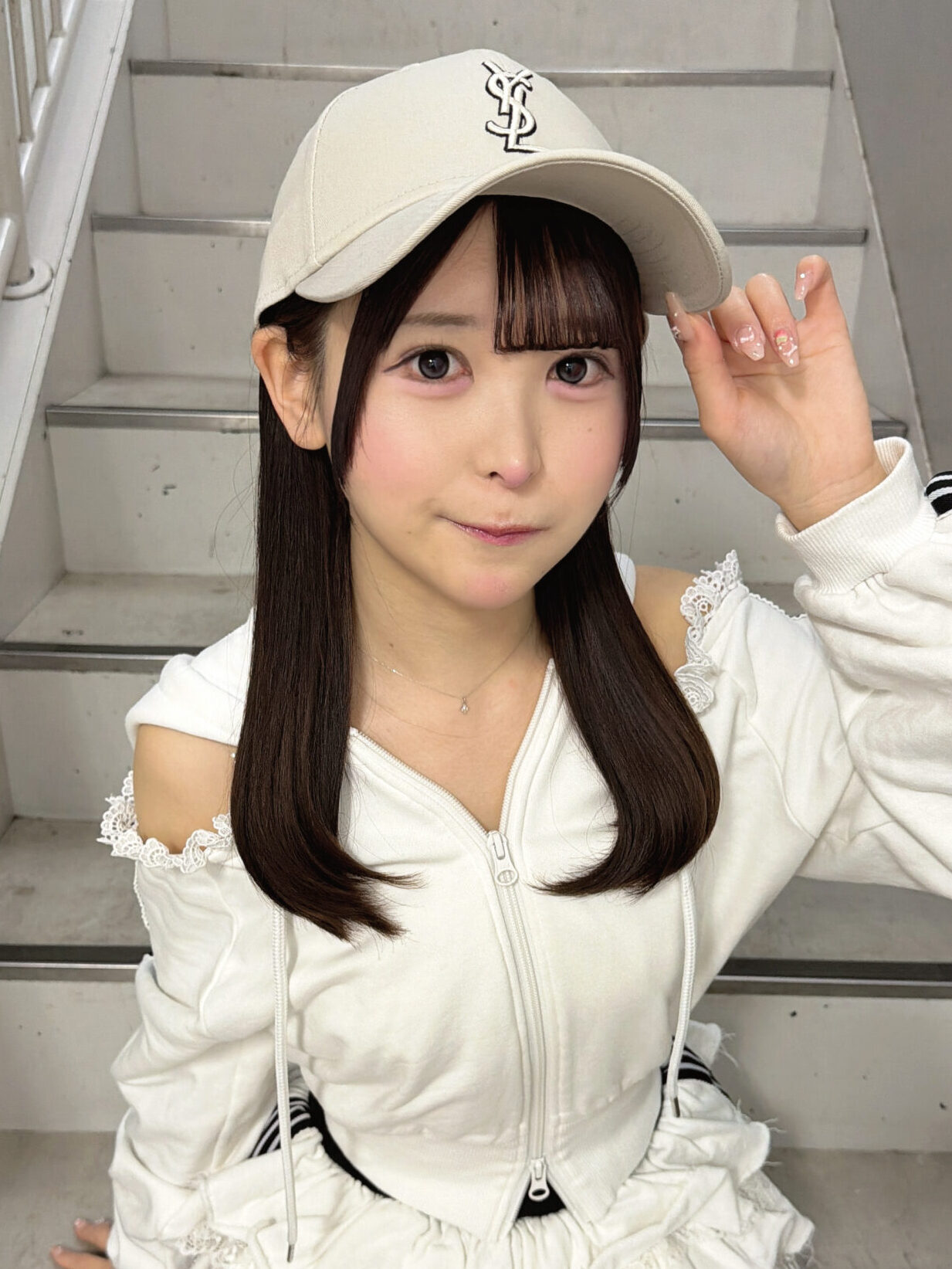 脂肪吸引注射(顔)の経過:術後3か月の症例写真と傷跡